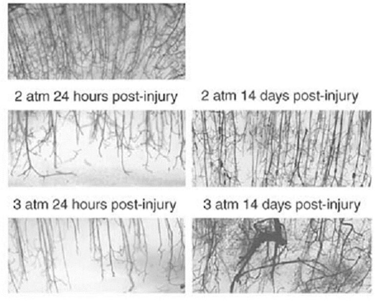 Histological analysis of small blood vessels in brain tissue from rodents subjected to experimental traumatic brain injury